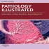 Pathology Illustrated